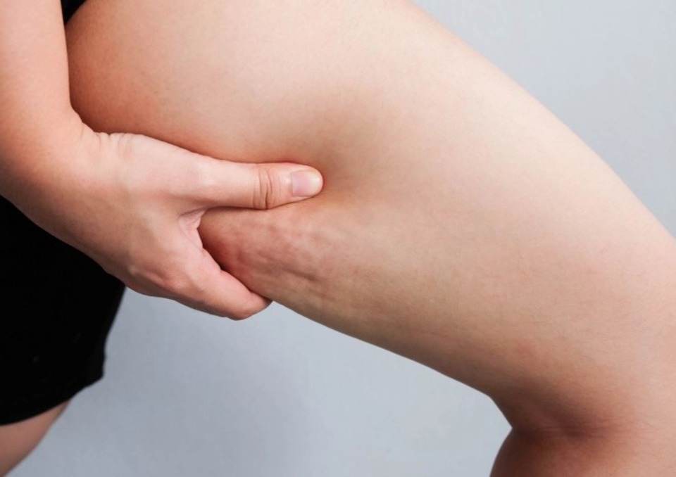 Alimente Care Ajută La Combaterea Celulitei